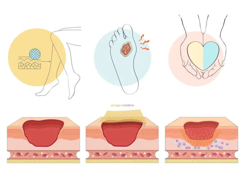 Examples of illustrations used for ProgenaCare Global and their product, ProgenaMatrix.